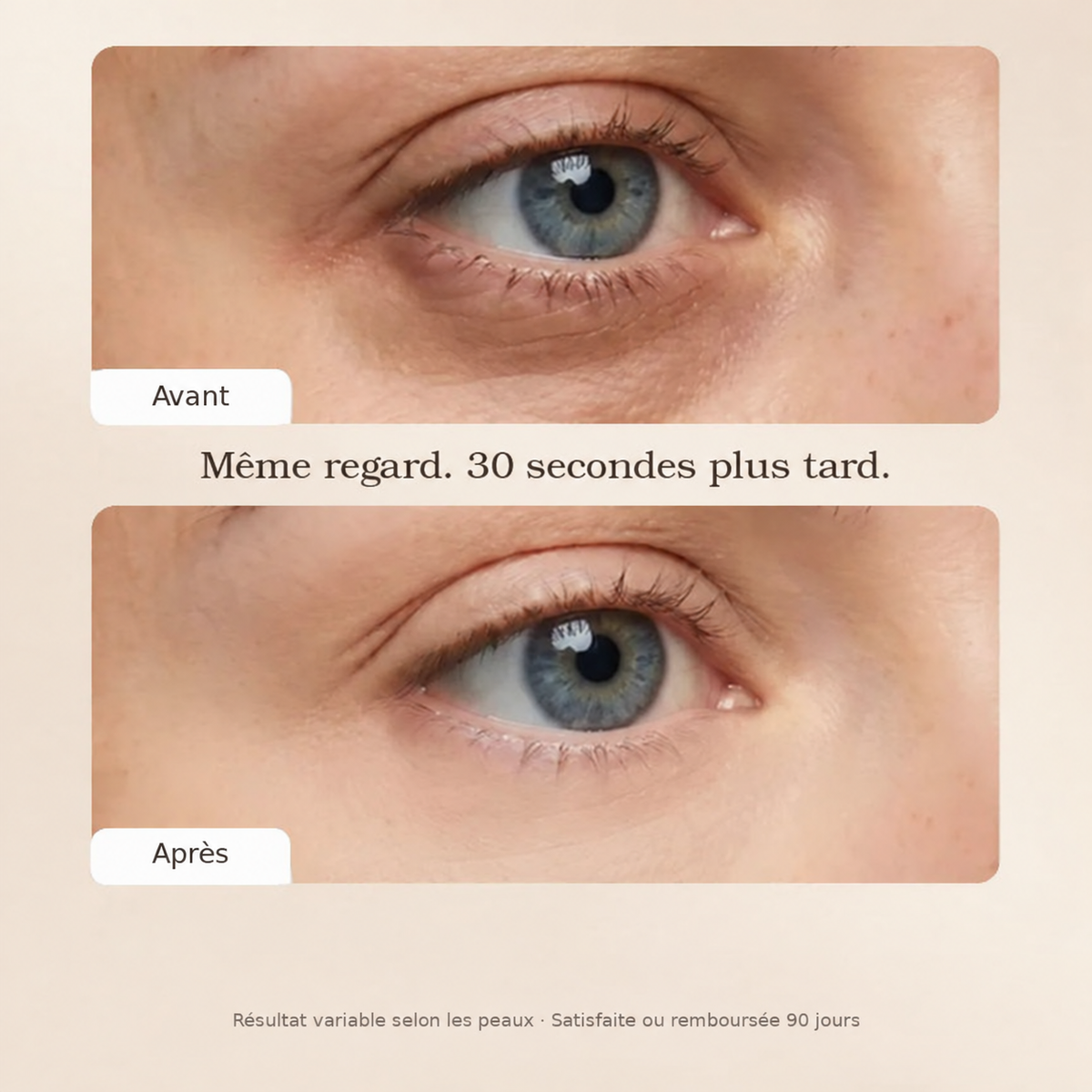 Correcteur crème anti-cernes Chère Peau