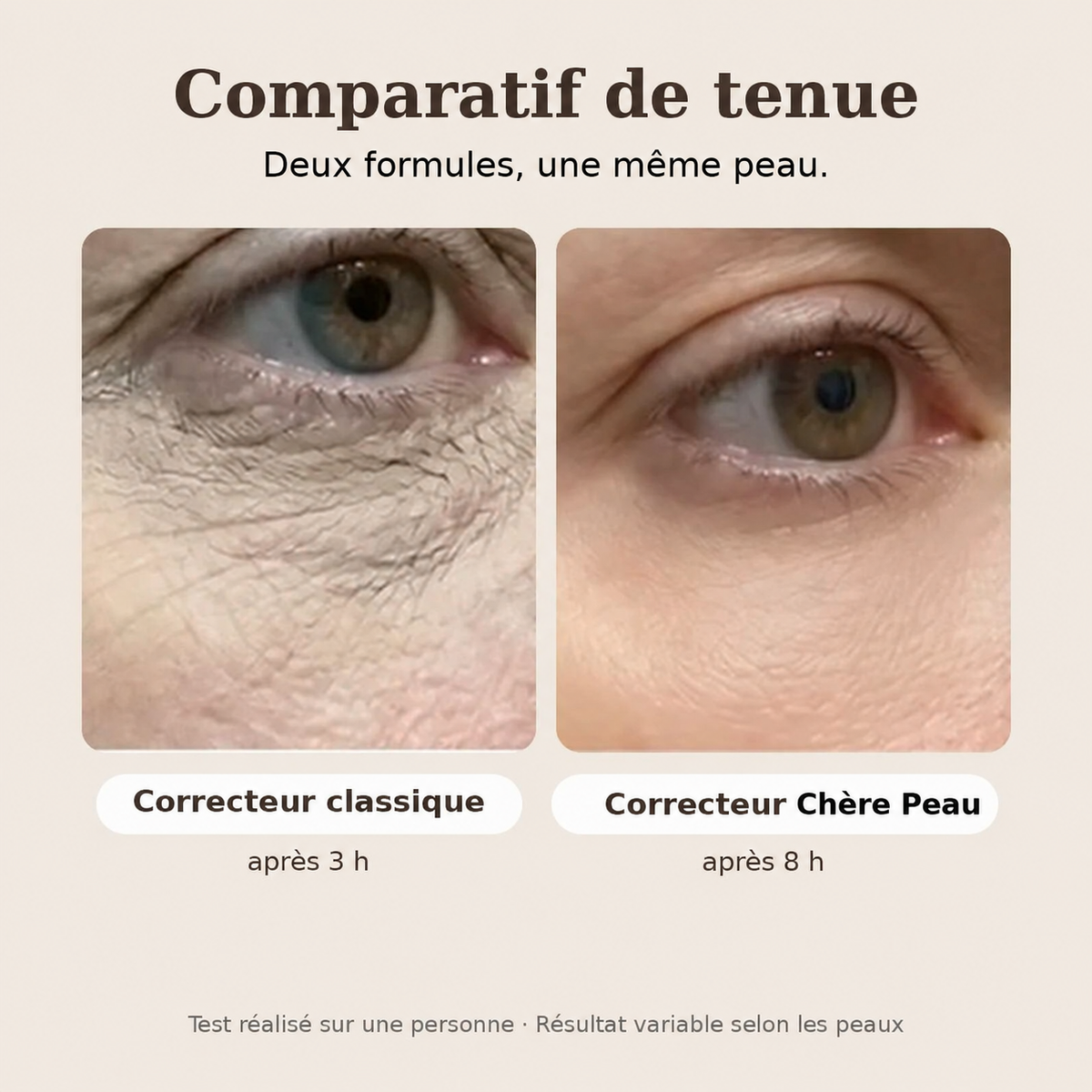Correcteur crème anti-cernes Chère Peau